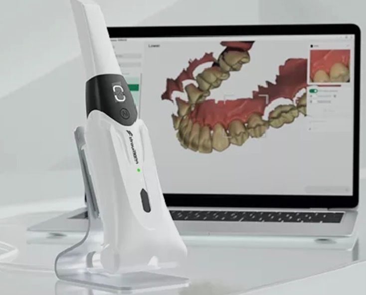 Escaneamento intraoral